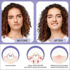 180 Pcs Pimple Patches