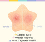 180 Pcs Pimple Patches